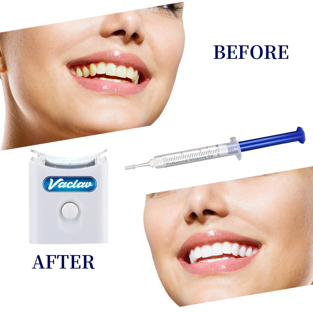 Żel do wybielania zębów w strz – Teeth Whitening Kit At Home recenzja i cena