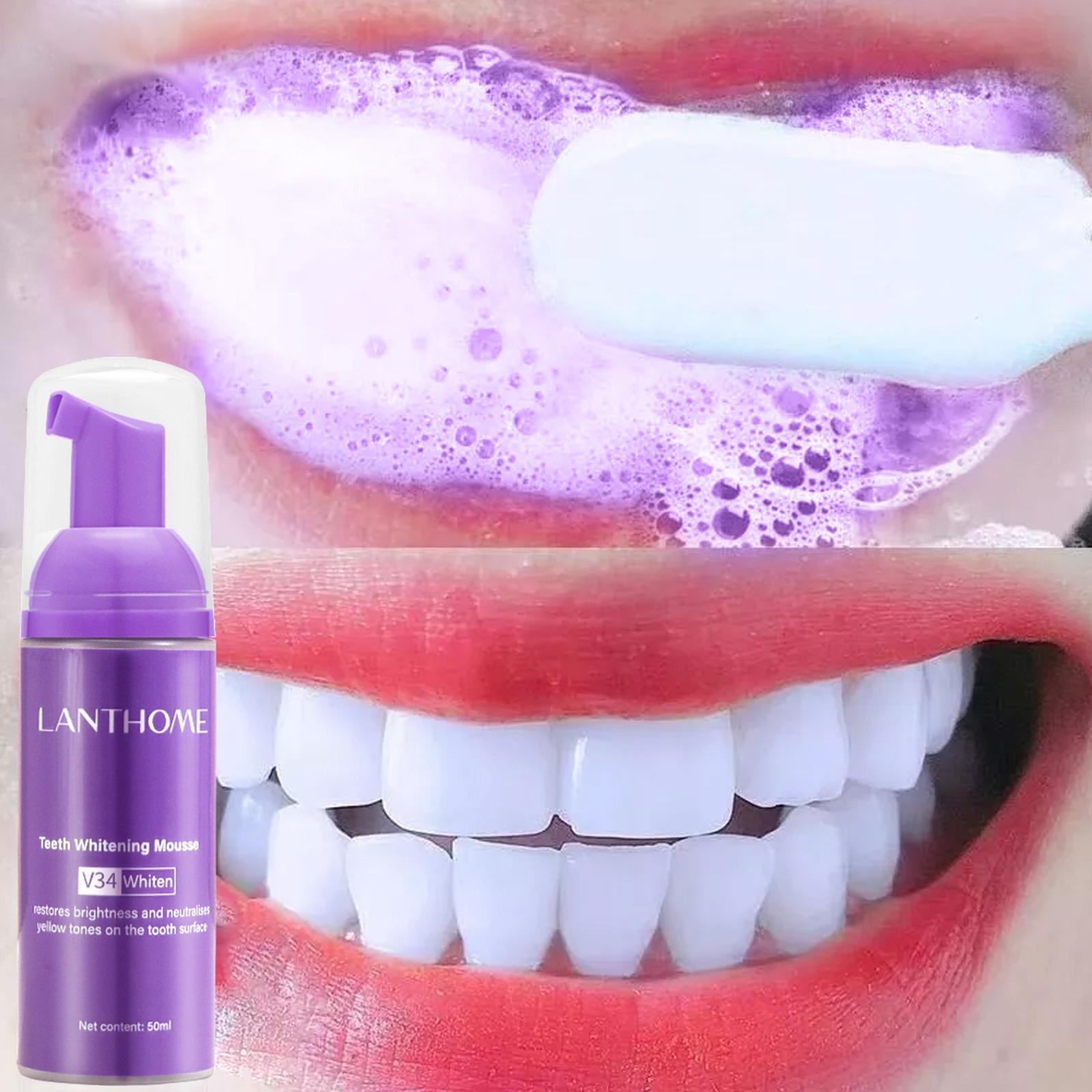 50ML mus wybielający zęby usuń – Teeth Whitening Mousse recenzja i cena
