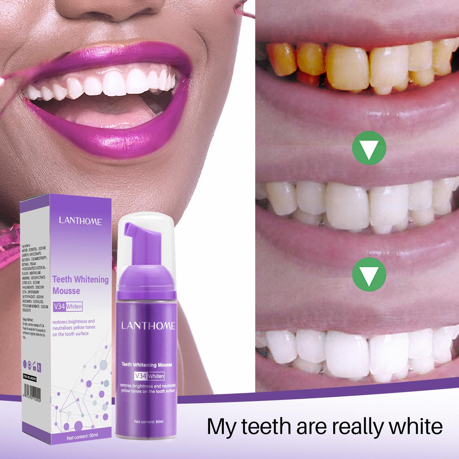 50ML mus wybielający zęby usuń – Teeth Whitening Mousse recenzja i cena