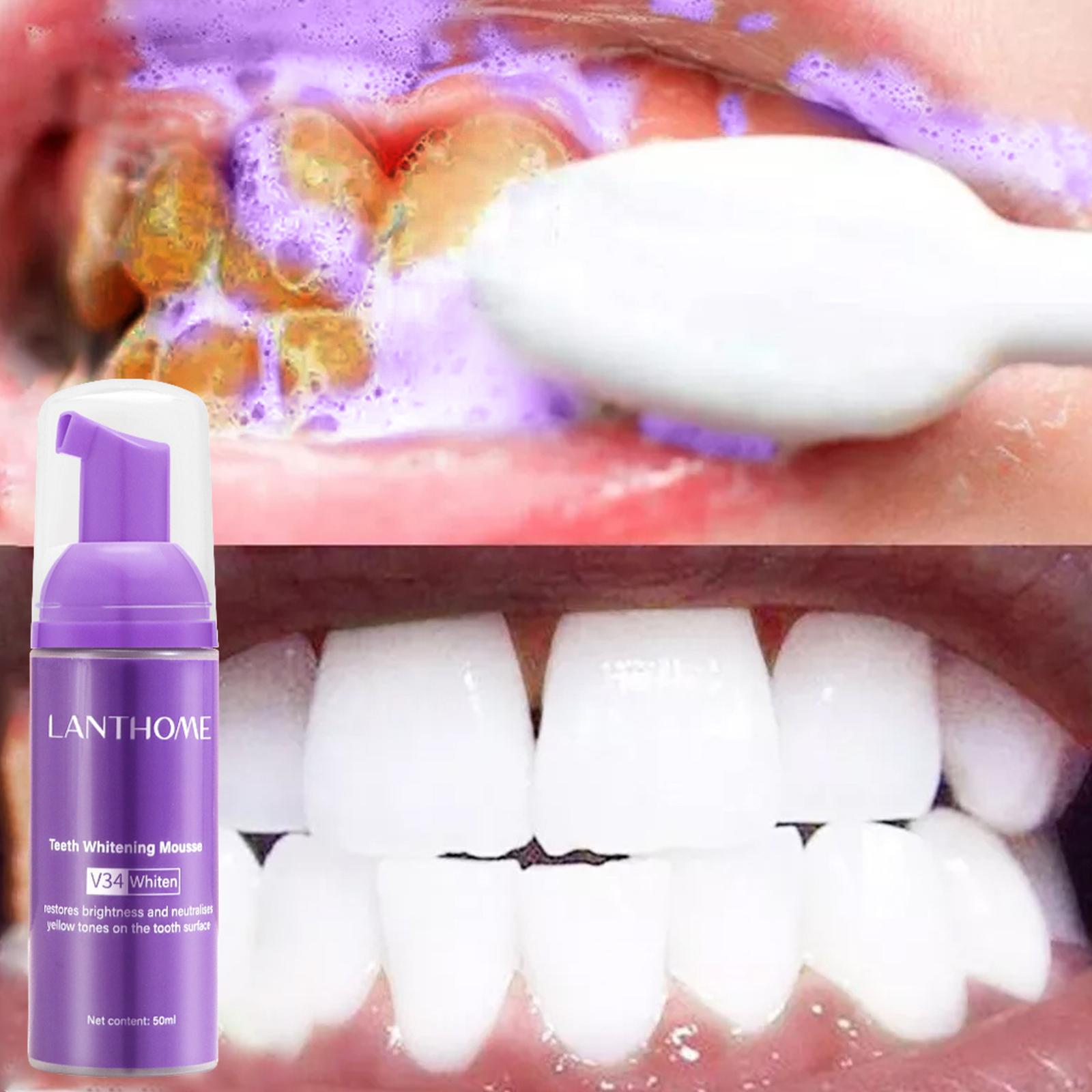 50ML mus wybielający zęby usuń – Teeth Whitening Mousse recenzja i cena