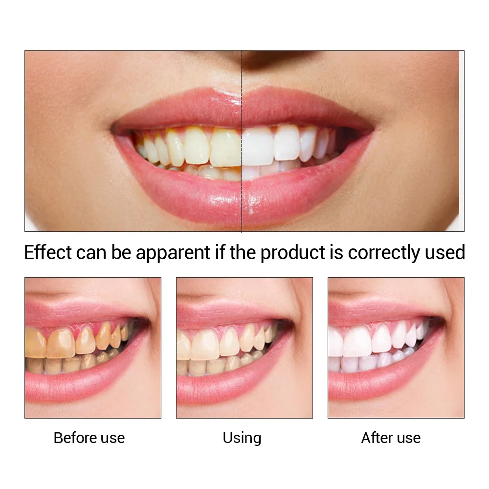 FTEENPLY esencja do wybielania – Teeth Whitening From Home recenzja i cena