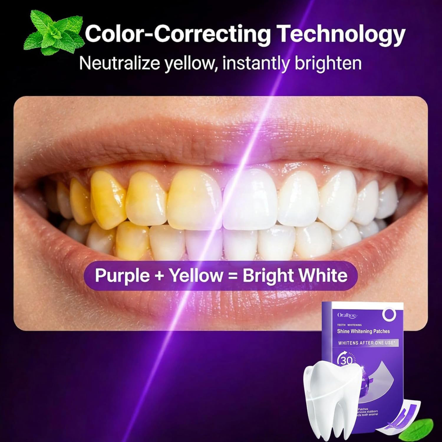 Fioletowy Zestaw do Wybielania – Teeth Whitening Mousse recenzja i cena