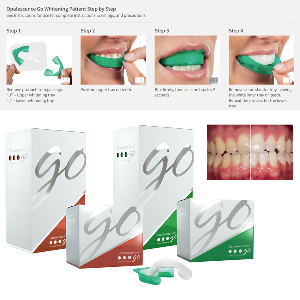 Opalescencja nakładki wybielaj – Teeth Whitening Kit At Home recenzja i cena