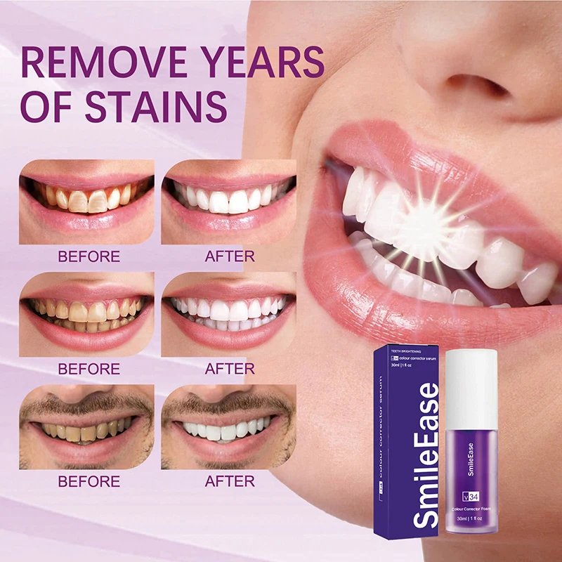 45ml Smilekit Purple Tooth Mou – Teeth Whitening Mousse recenzja i cena