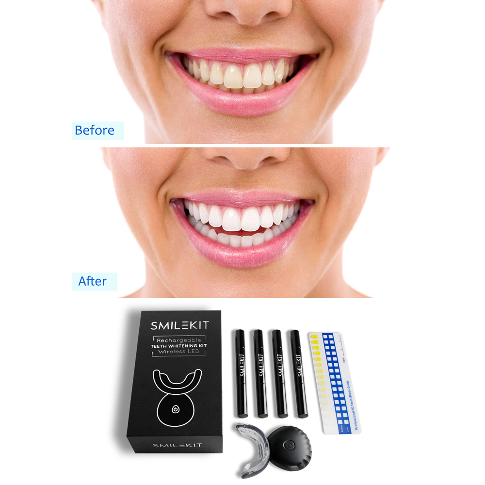 Nowe elektryczne wybielanie zę – Teeth Whitening Home Kit recenzja i cena